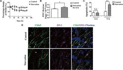 Autophagy Protects the Blood-Brain Barrier Through Regulating the Dynamic of Claudin-5 in Short-Term Starvation